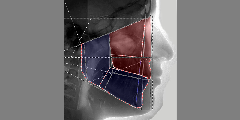 Analyse topographique